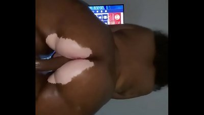 Vitiligo Instagram model Liyahthebunni lubricated culo